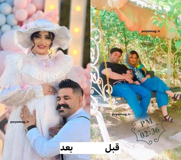 فرشته محمودی قبل و بعد