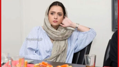 بیماری ترانه علیدوستی چیست ؟ + عکس دست ترانه علیدوستی 3 ترانه علیدوستی